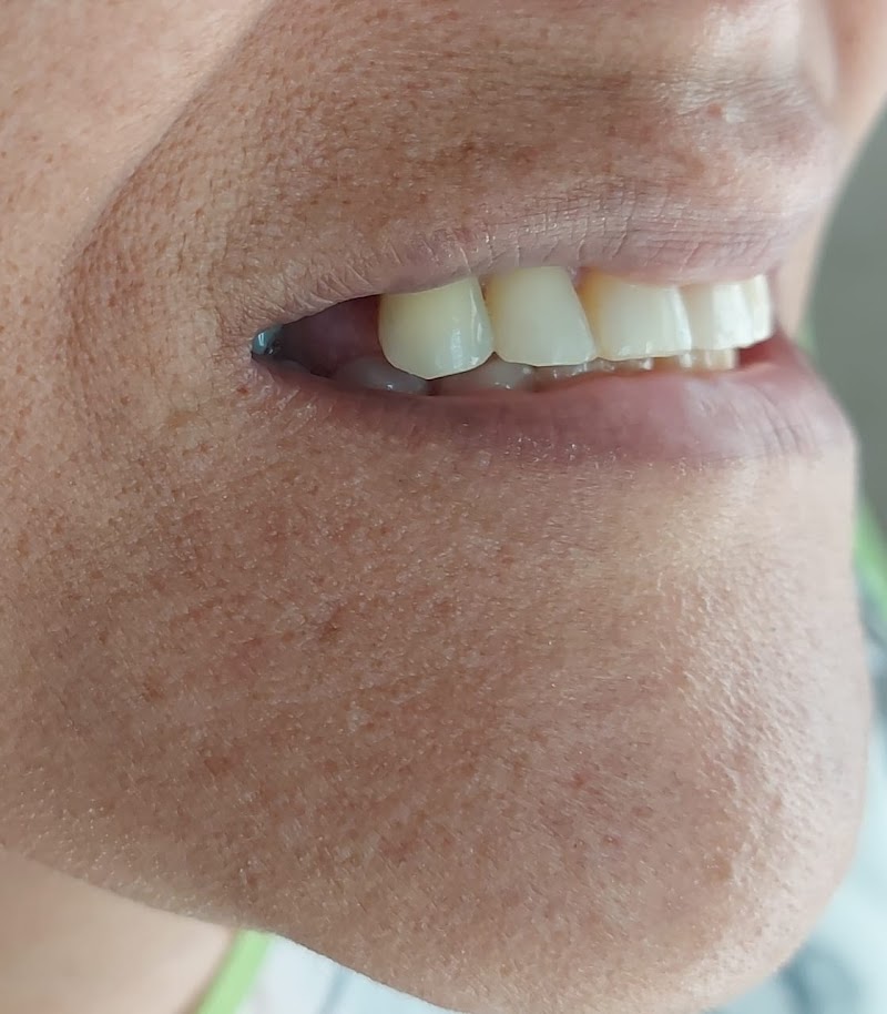 Dentista Dra. Natália Oliveira | Lentes de Resina, Prótese fixa, e Botox | Campo Grande-RJ - foto 4