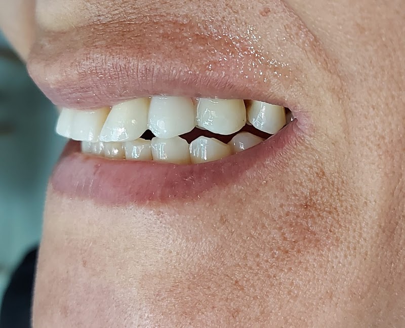 Dentista Dra. Natália Oliveira | Lentes de Resina, Prótese fixa, e Botox | Campo Grande-RJ - foto 3