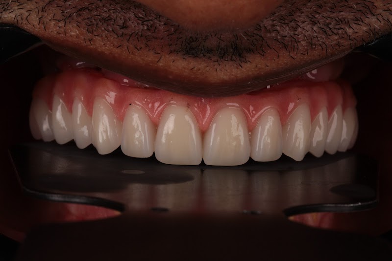 Dr.Edson Ferreira implantes e reabilitação oral - foto 3