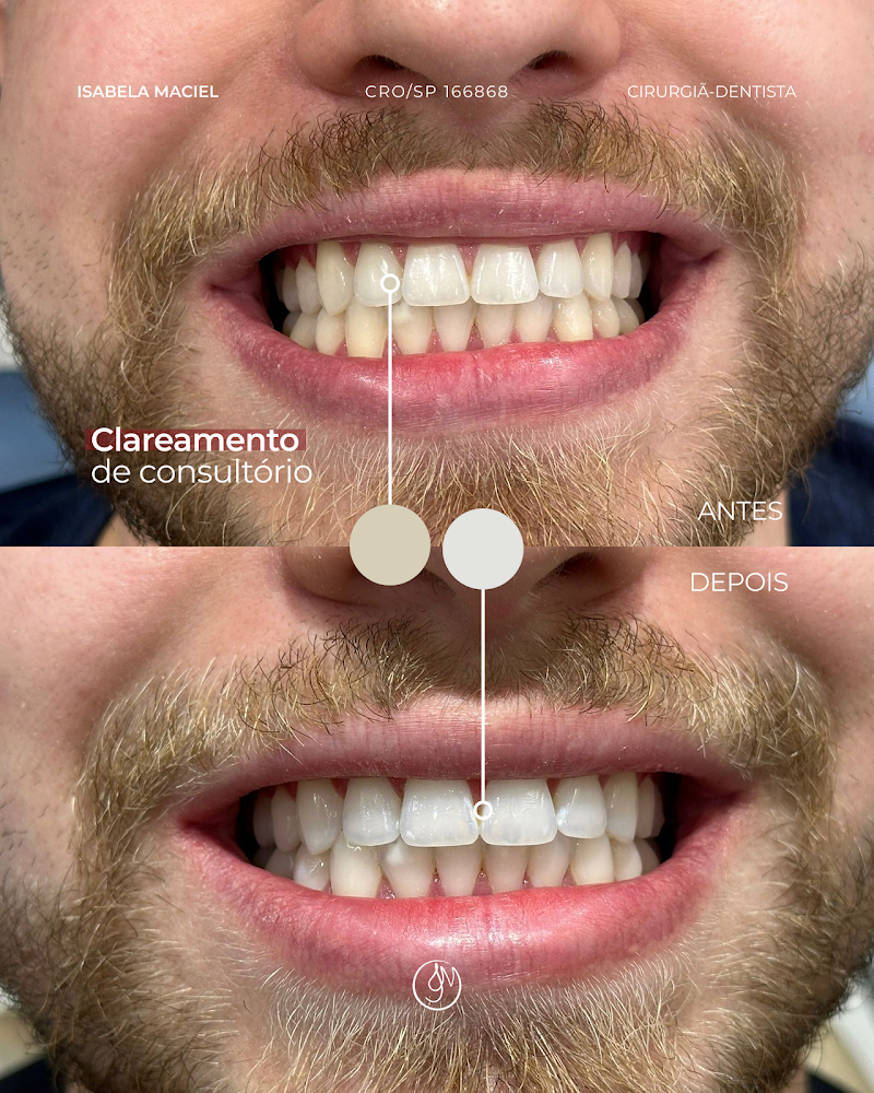 Dra. Isabela Maciel | Clareamento dental, Restaurações, Tratamento de canal - foto 5