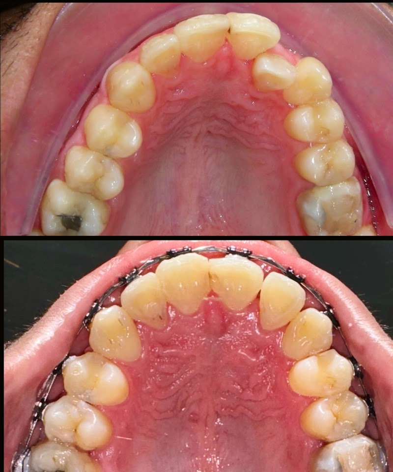 Prime Odonto em Recife - Clareamento dental em Recife | Aparelho dentário em Recife - foto 2