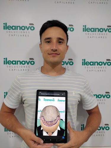 INJERTO CAPILAR ILEANOVO LIMA | IMPLANTE DE CABELLO ILEANOVO | TRASPLANTE CAPILAR ILEANOVO | INJERTO DE PELO logo