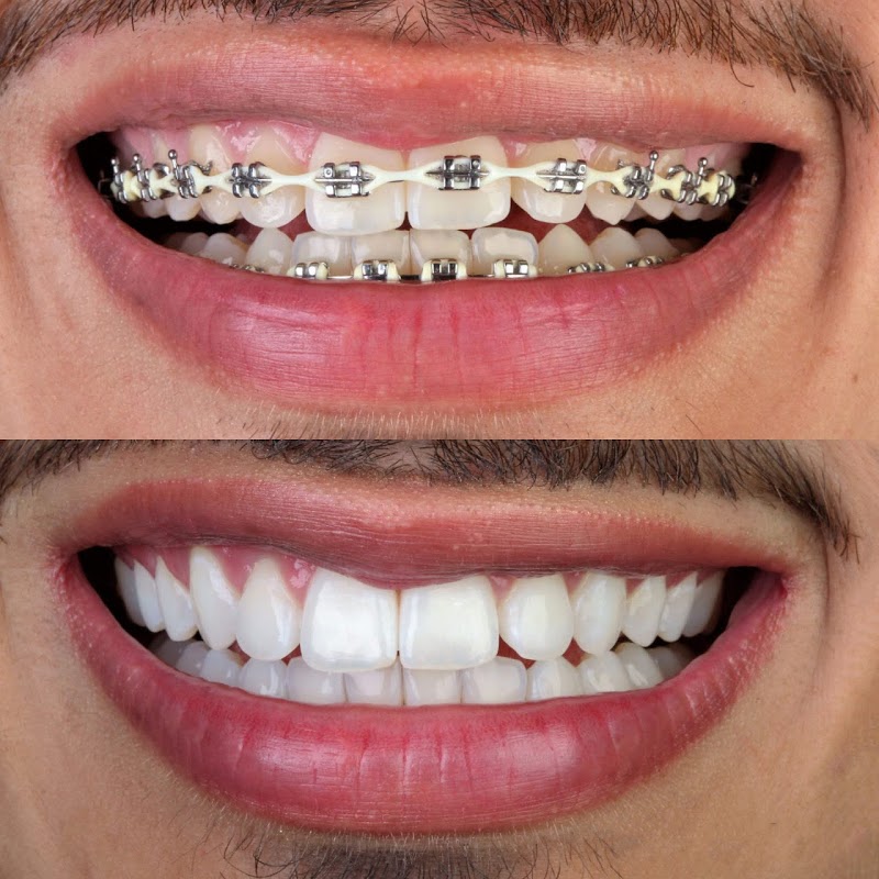 Allegra Odontologia Tatuapé | Estética Dental - foto 4