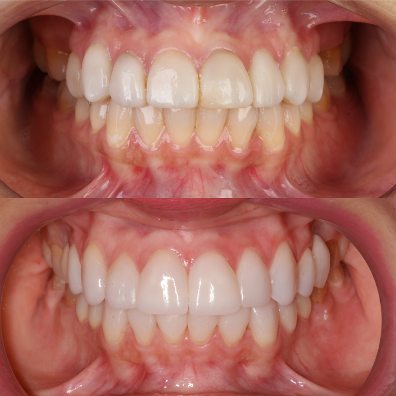Allegra Odontologia Tatuapé | Estética Dental - foto 3