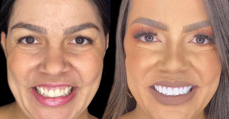 Odontolentes Savassi - foto 4