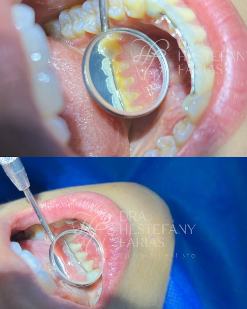 Dra. Hestefany Farias – Limpeza e Clareamento Dental em Vitória ES - foto 3