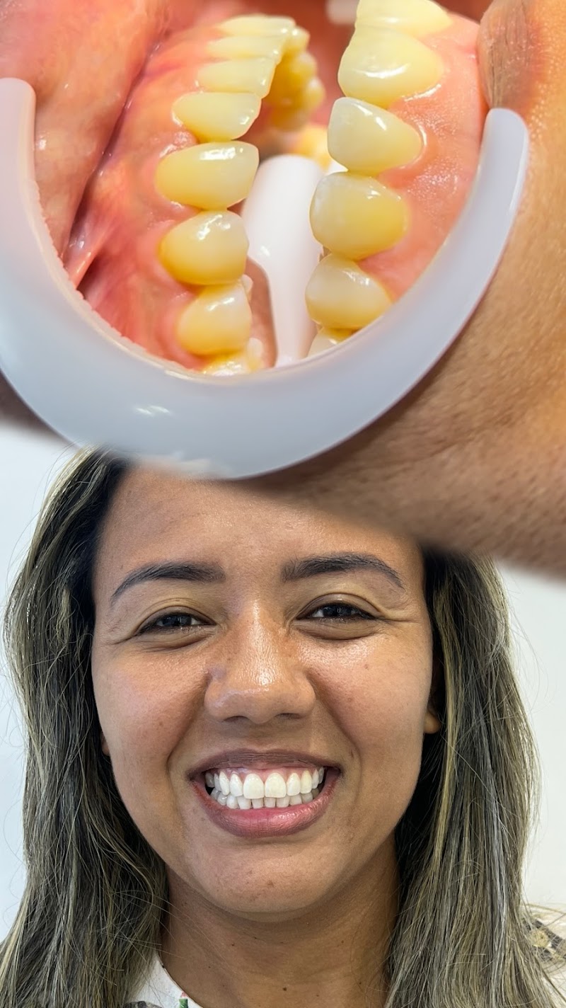 Dra. Hestefany Farias – Limpeza e Clareamento Dental em Vitória ES - foto 4