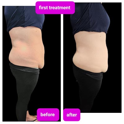 Flawless Contour photo 3