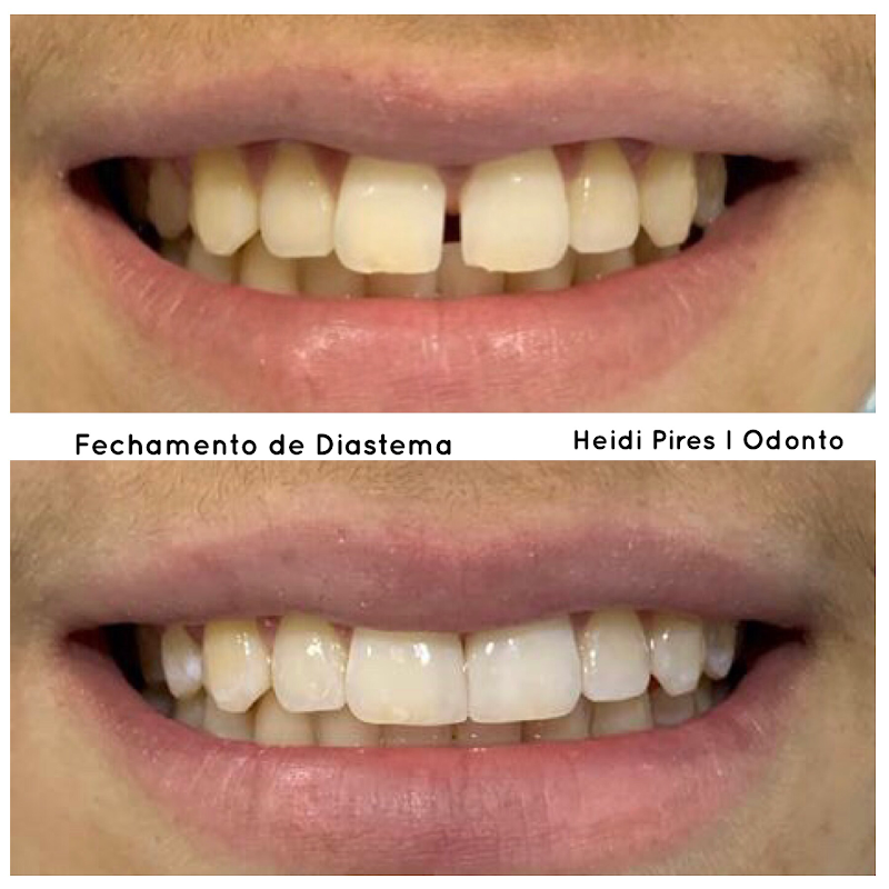 Heidi Pires I Odontologia - foto 4