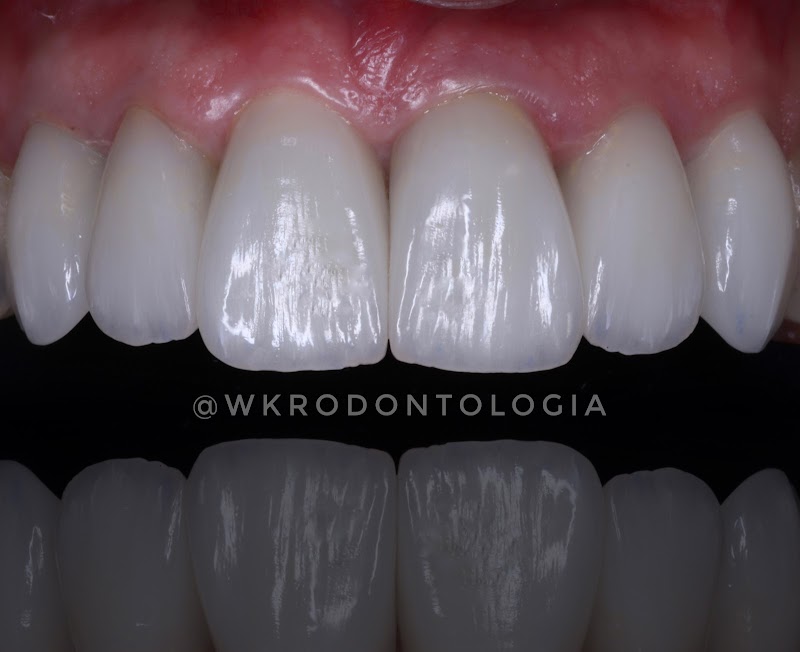 WK•R ODONTOLOGIA | Dentista Porto Alegre | Lente de Contato Dental / Implante Dentário / Invisalign / Zona Norte Porto Alegre