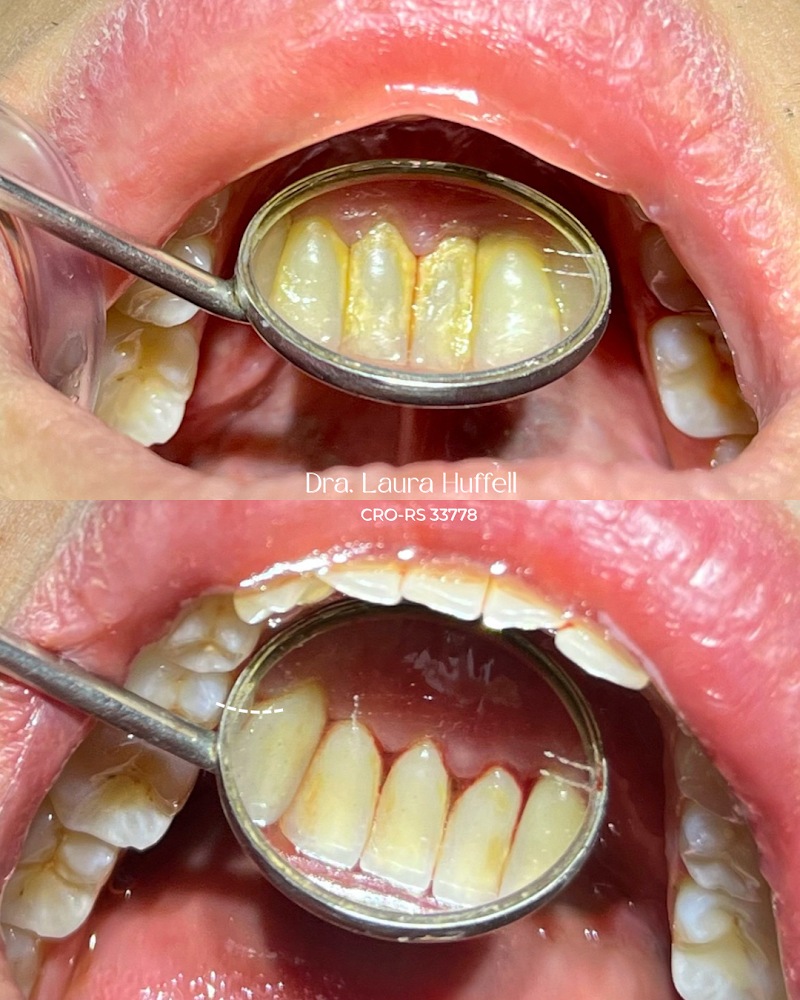 Dra. Laura Huffell | Cirurgiã-dentista - foto 4