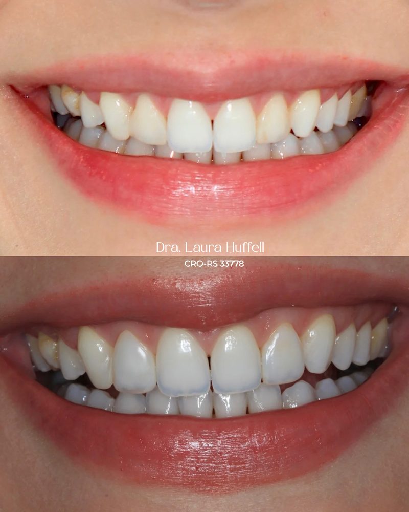 Dra. Laura Huffell | Cirurgiã-dentista - foto 5