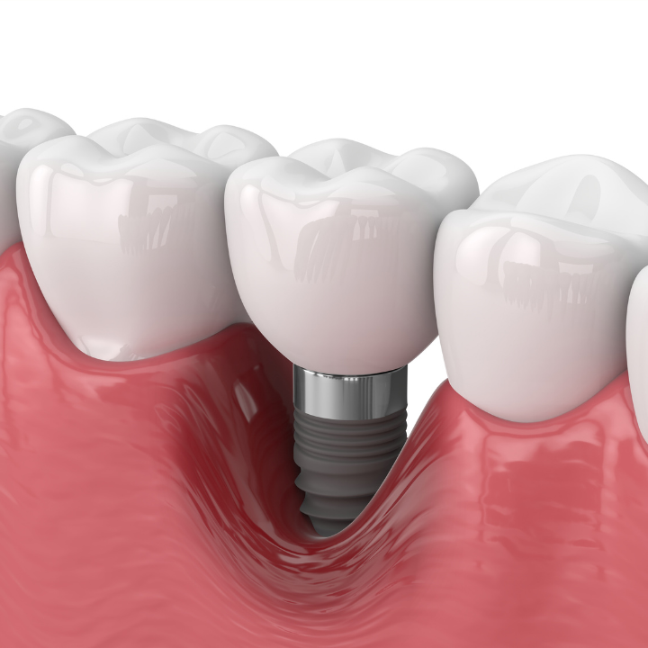 Dr. Rinaldo Cavatti, Dentista Nova Iguaçu - foto 3