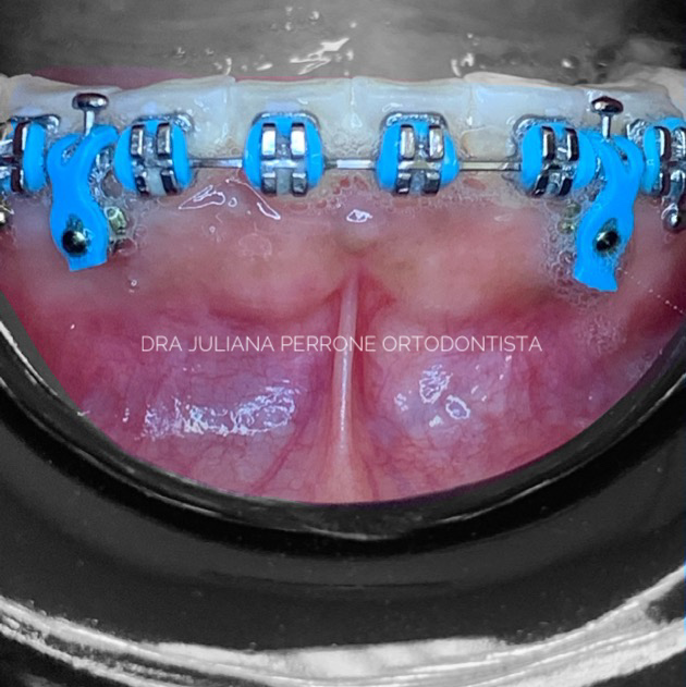 Dra. Juliana Perrone, Dentista - foto 2