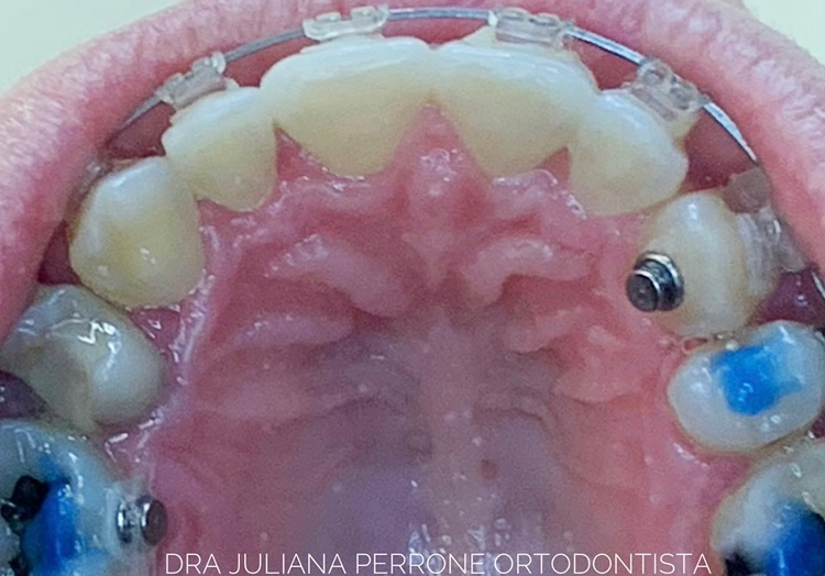 Dra. Juliana Perrone, Dentista - foto 4