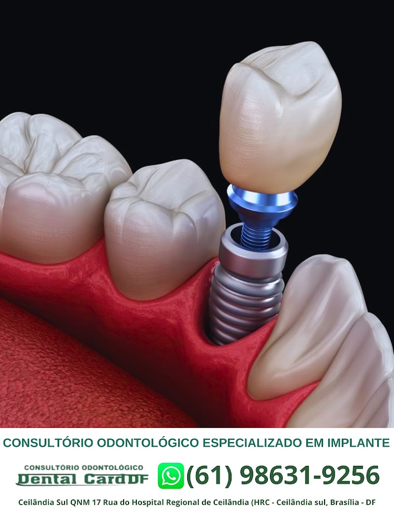 Dental Card Ceilândia Sul - foto 4