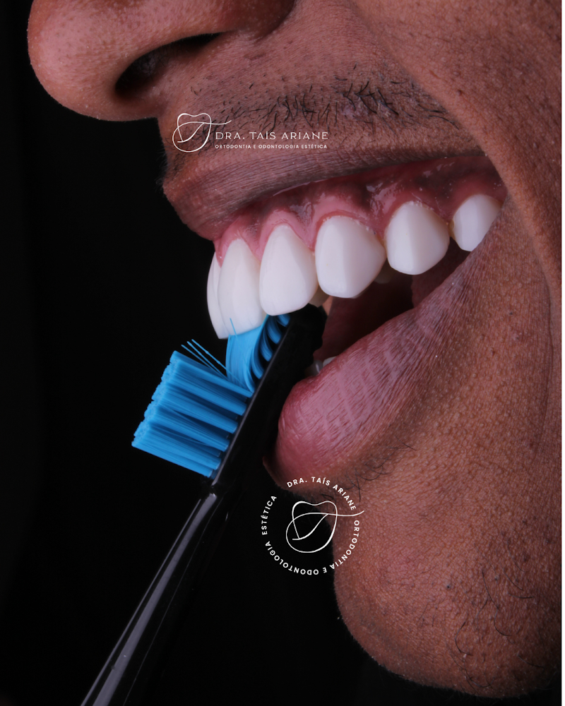 Dentista Recreio dos Bandeirantes | Ortodontista | Consultório Odontológico Dra. Taís Ariane | - foto 5