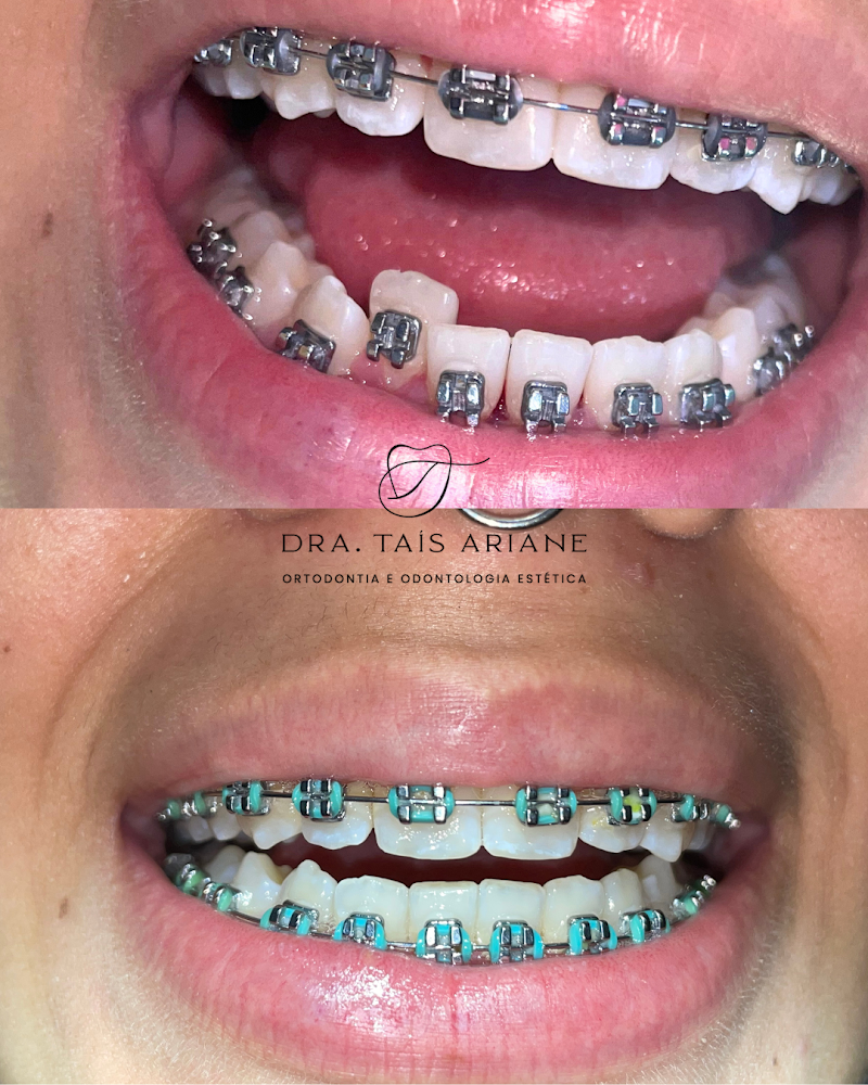 Dentista Recreio dos Bandeirantes | Ortodontista | Consultório Odontológico Dra. Taís Ariane | - foto 2
