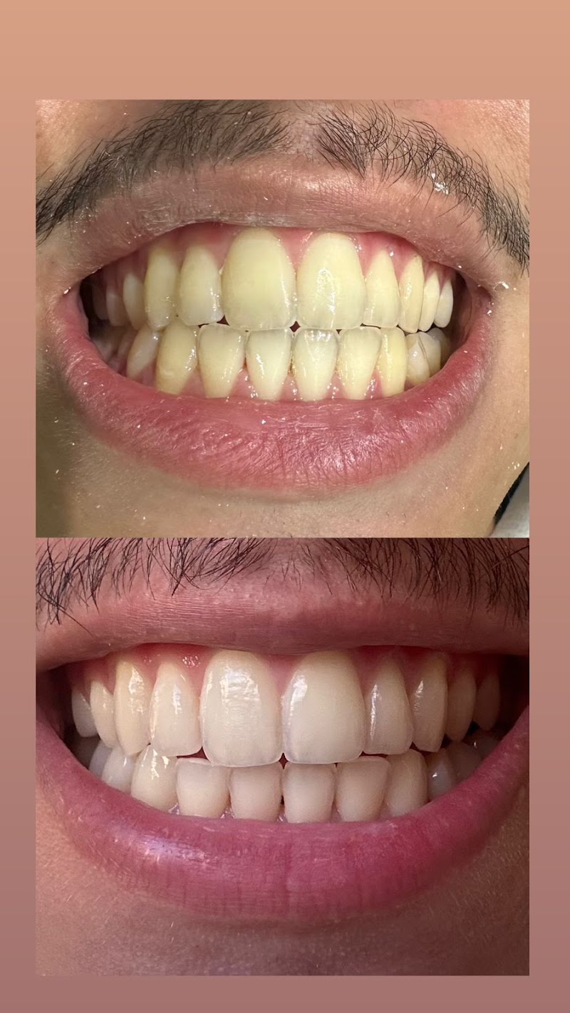 Dra Manuela Oliveira - Dentista - Ortodontista - Alinhador invisível - Invisalign - SouSmile - Implante dentário - Recreio - foto 3