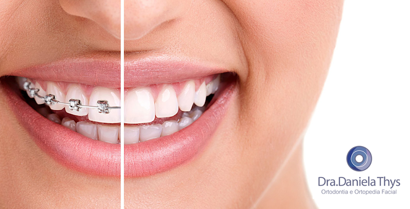 Dra. Daniela Thys Ortodontista - Florianópolis - foto 3
