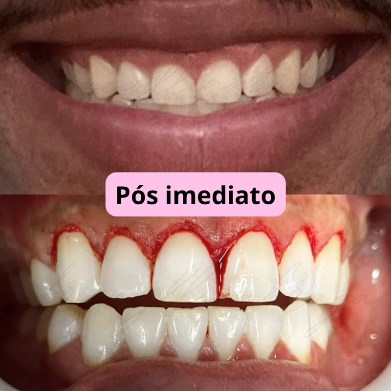 Dra Myllena Braga | CIRURGIÃ DENTISTA - foto 4