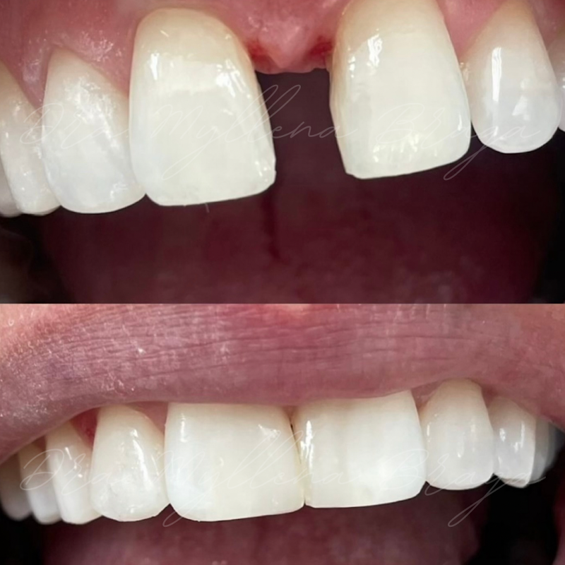 Dra Myllena Braga | CIRURGIÃ DENTISTA - foto 5