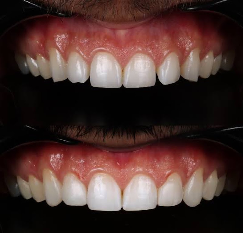 Dra Myllena Braga | CIRURGIÃ DENTISTA - foto 3