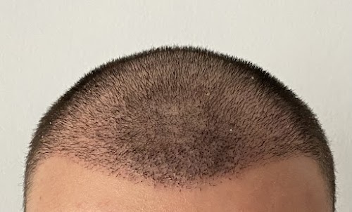 One Hair Clinic Transplantation - Plastic Esthetic logo