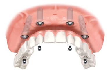 Gallery 5