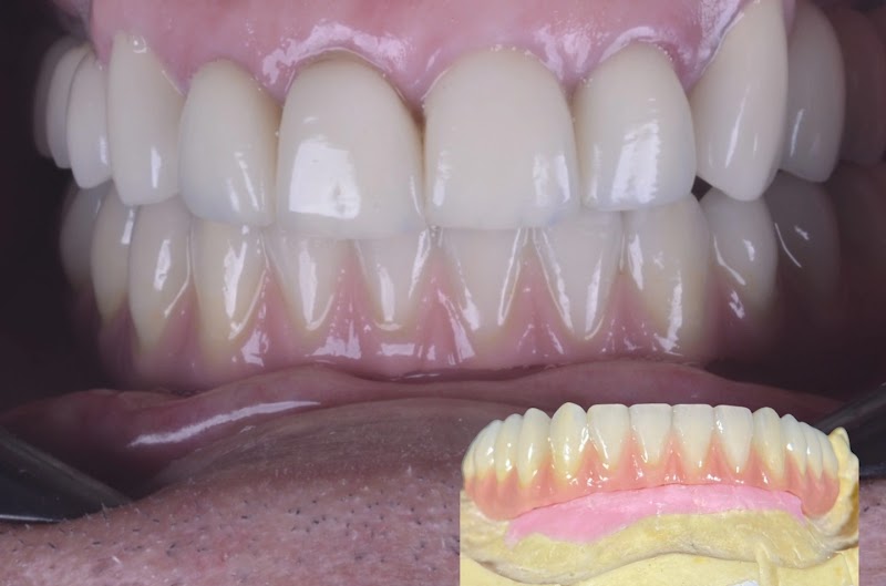 Oliveira Prates estética dental - foto 5