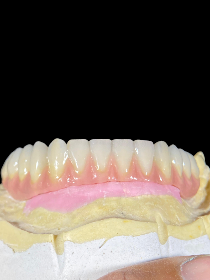 Oliveira Prates estética dental