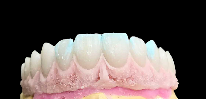 Oliveira Prates estética dental - foto 2