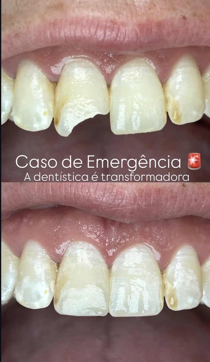 Dentista Ingleses - Dr. Leandro Nunes - foto 3