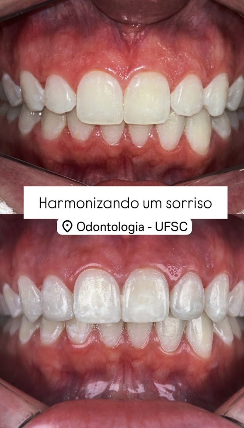 Dentista Ingleses - Dr. Leandro Nunes