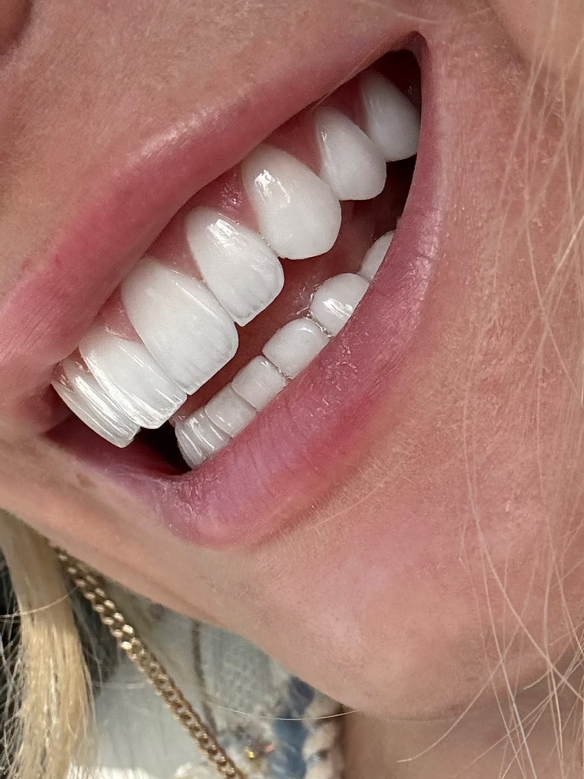 Dr. Ali Halim Cosmetic Dental Clinic 3