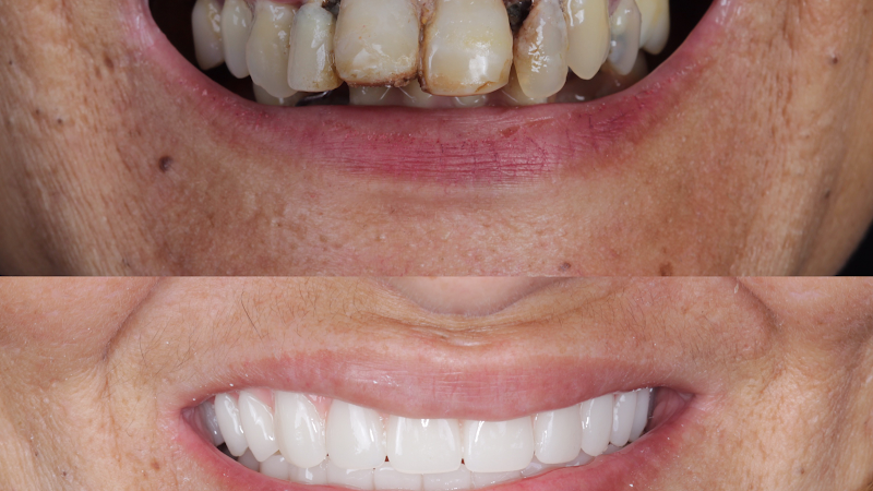 Odontovic - Implantes Dentários - Madureira