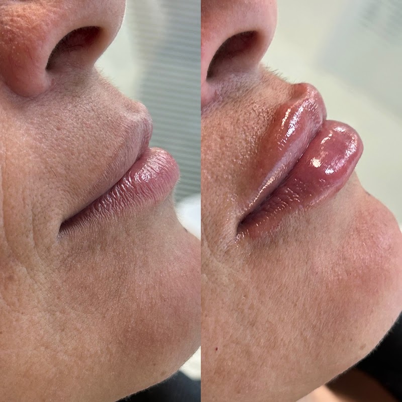 Dra. Izabella Almeida - Harmonização Facial - foto 5