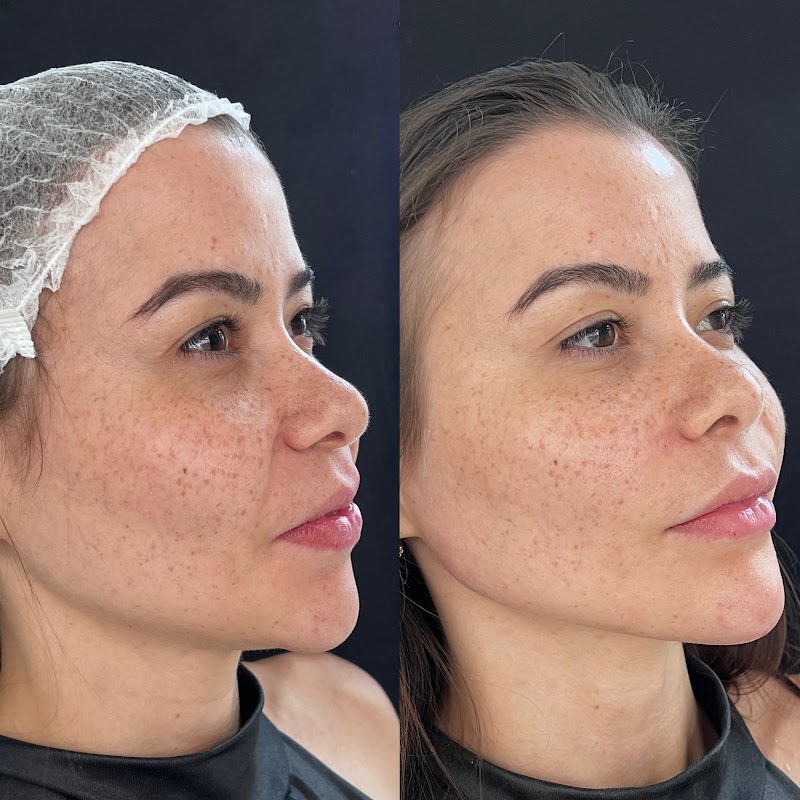 Dra. Izabella Almeida - Harmonização Facial - foto 2