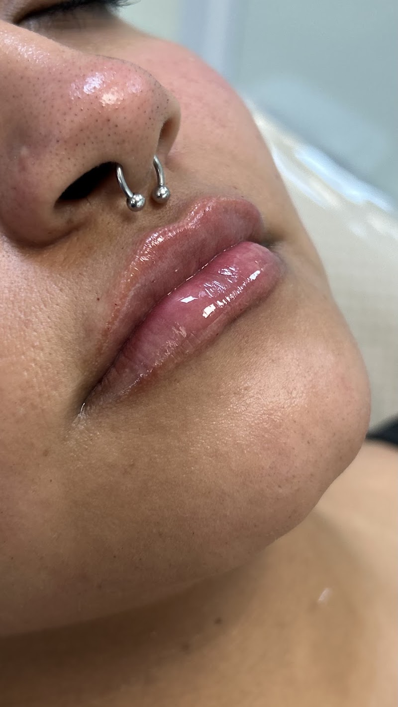 Dra. Izabella Almeida - Harmonização Facial - foto 4