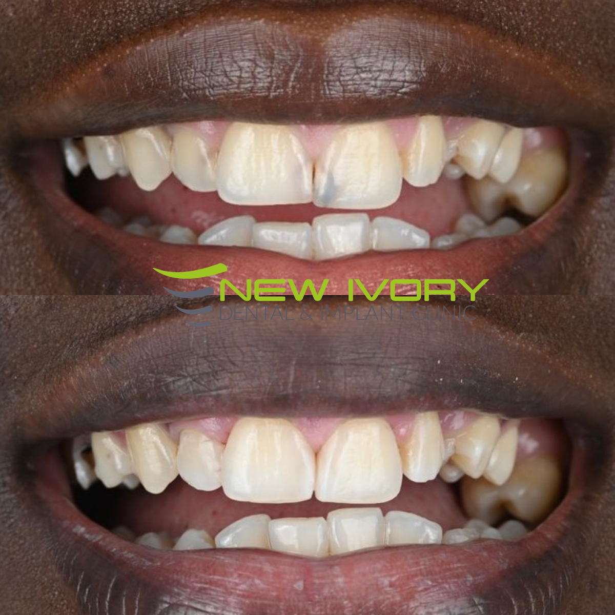 New Ivory Dental & Implant Clinic 4