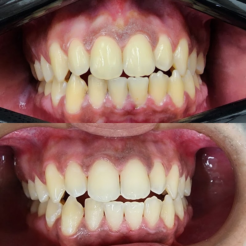 Dra Camila Canellas - CMR Odontologia - Lente Contato Dental | Implante Dentário - foto 2