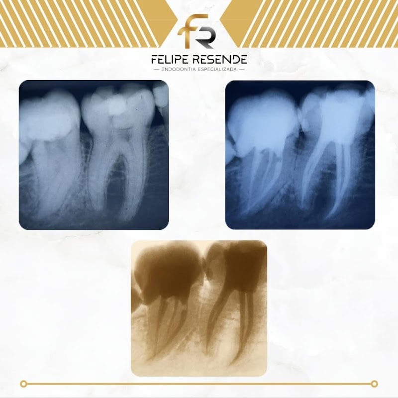 Dr. Felipe Resende - Especialista em Endodontia e Prótese - foto 5