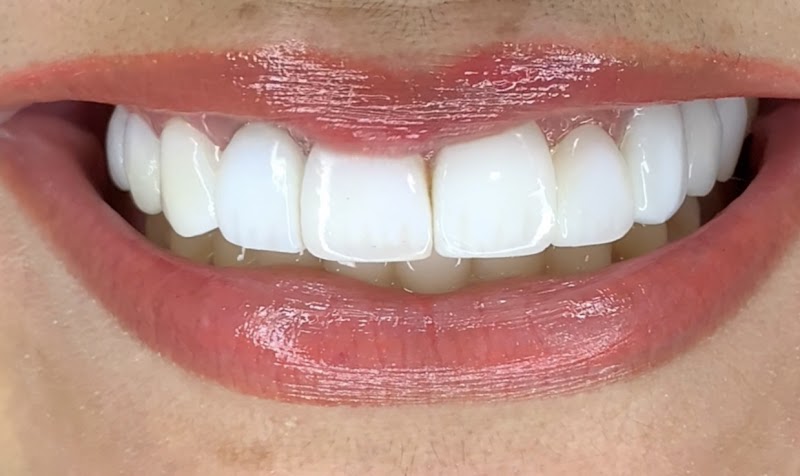 Suzano Odontologia - Dentista 24H