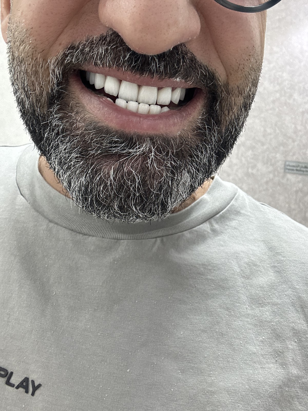 Dr. Racha Ghazal Cosmetic Dentistry Clinic 4
