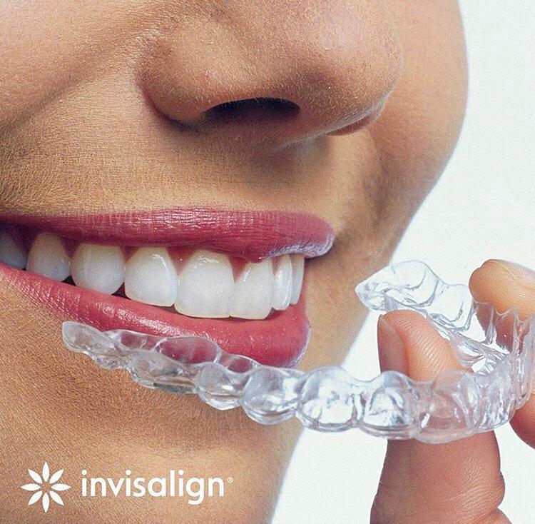 Dra. Priscilla Flores - Ortodontia/ Aparelho Invisível/ Invisalign AP - foto 5