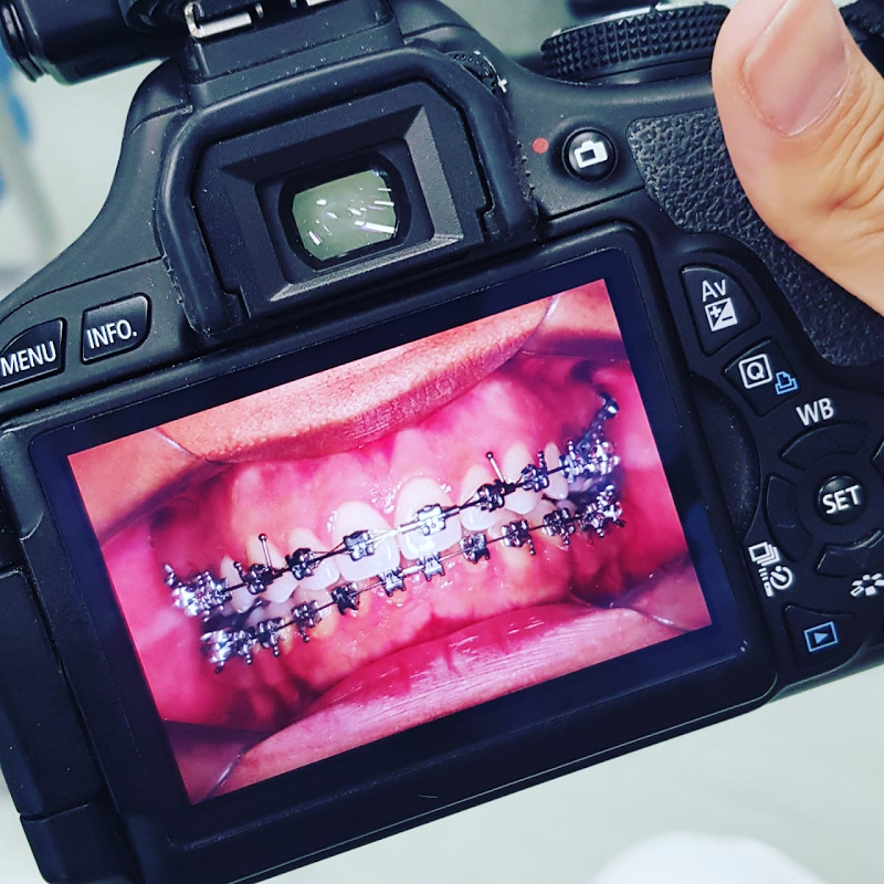 Ortodontia Dra Laís Gevisiez De Abreu - foto 3