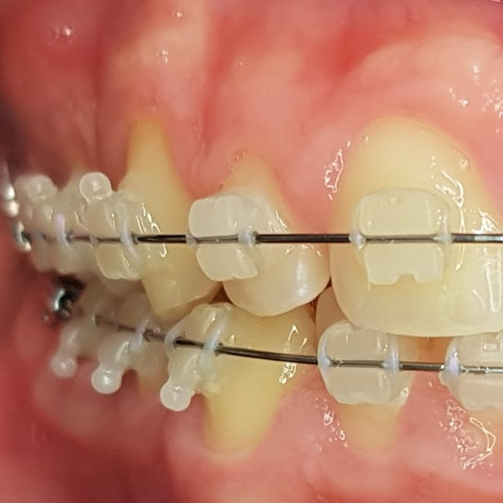 Ortodontia Dra Laís Gevisiez De Abreu - foto 2