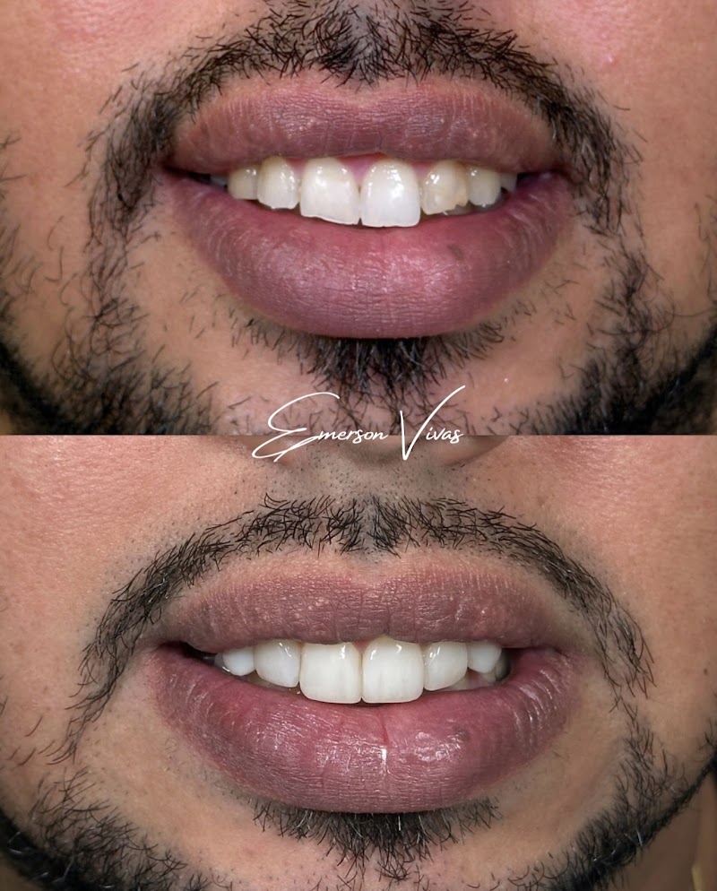 Dr. Emerson Vivas Dentista em Botafogo | Clínica Odontológica em Botafogo Dr. Emerson Vivas - foto 4