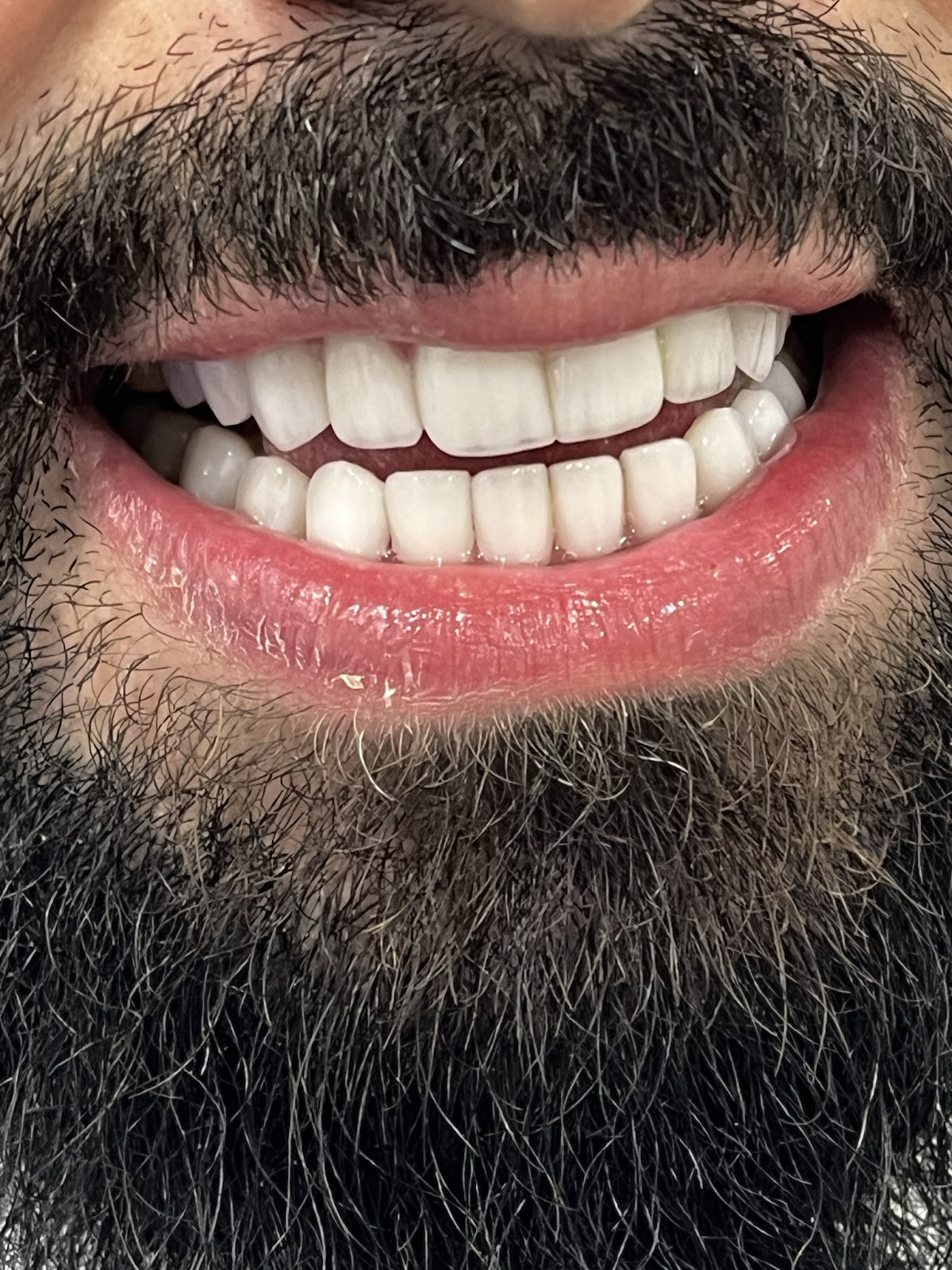 Dr Nour Nasser - Cosmetic Dentist
