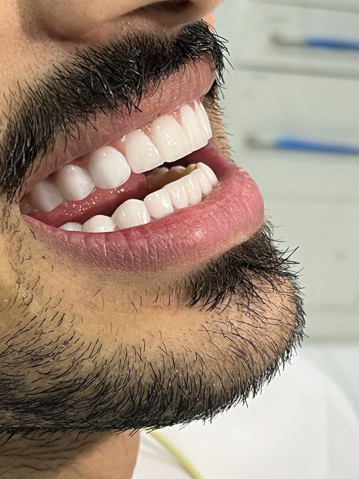 Dr Nour Nasser - Cosmetic Dentist 2